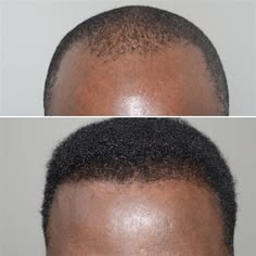 Hair Pro