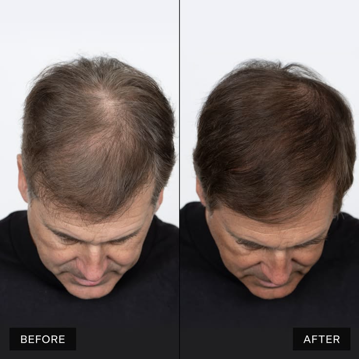 Hair Pro