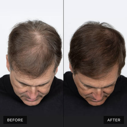 Hair Pro