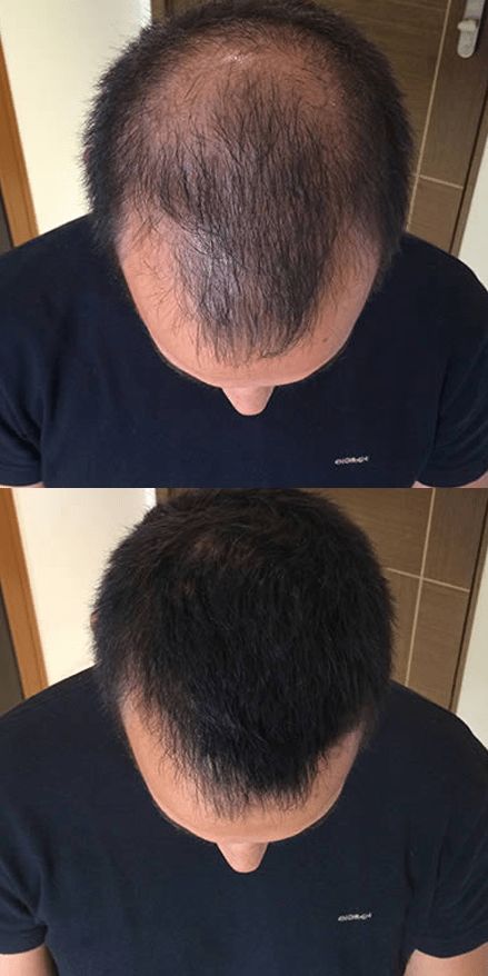 Hair Pro