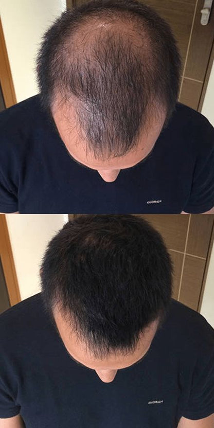 Hair Pro