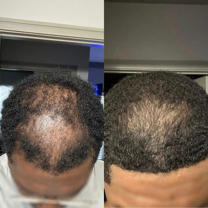 Hair Pro
