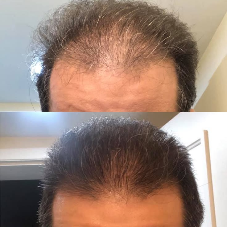 Hair Pro